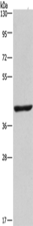 Anti-NME7 Rabbit Polyclonal Antibody