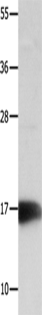 Anti-NME3 Rabbit Polyclonal Antibody