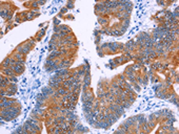 Anti-NR4A2 Rabbit Polyclonal Antibody