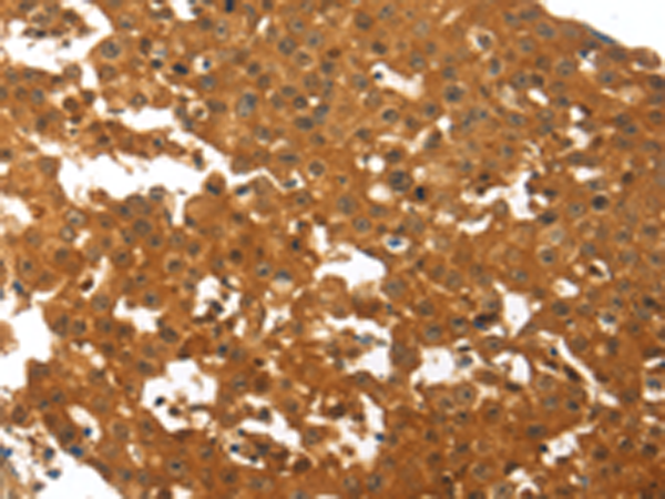 Anti-Osteoprotegerin Rabbit Polyclonal Antibody
