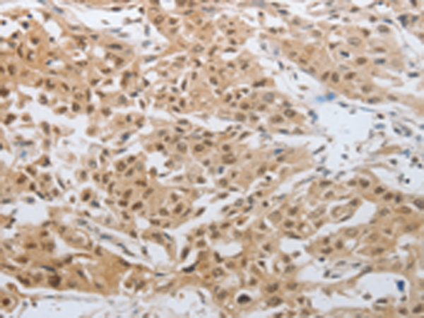 Anti-DNAJC7 Rabbit Polyclonal Antibody