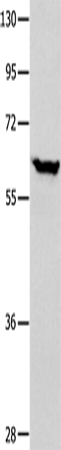 Anti-DNAJC7 Rabbit Polyclonal Antibody
