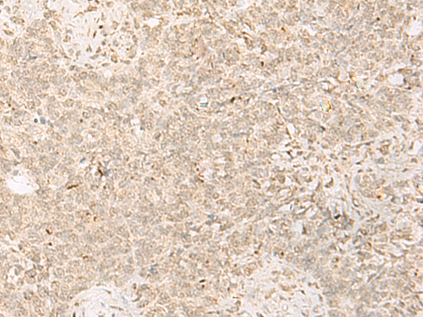 Anti-PADI4 Rabbit Polyclonal Antibody