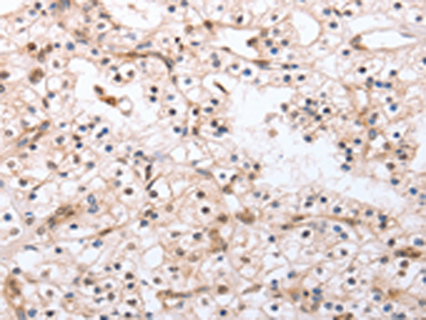 Anti-PDCD10 Rabbit Polyclonal Antibody