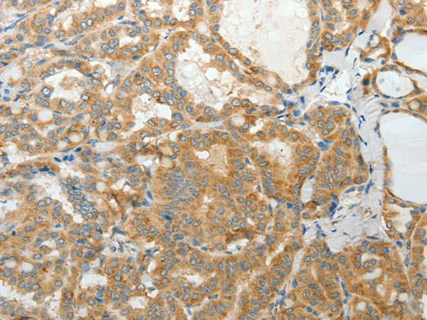 Anti-PRPH Rabbit Polyclonal Antibody