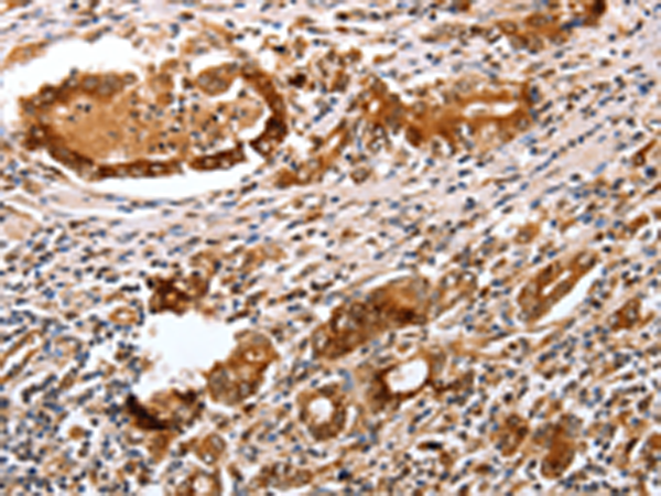 Anti-PEPC Rabbit Polyclonal Antibody
