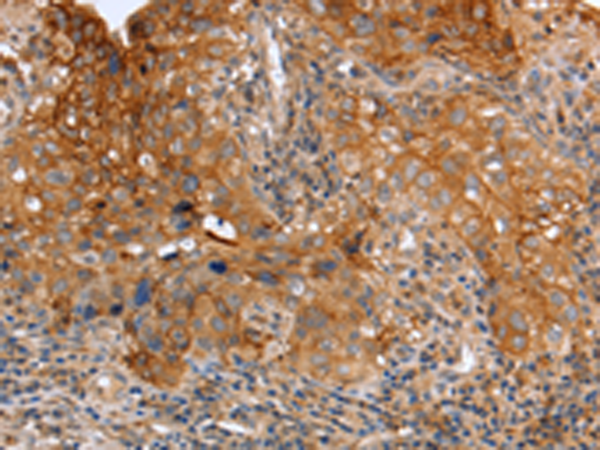 Anti-uPA Receptor Rabbit Polyclonal Antibody
