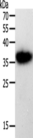 Anti-uPA Receptor Rabbit Polyclonal Antibody
