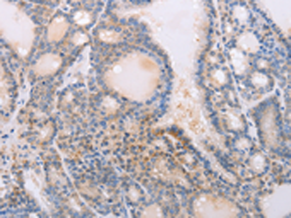 Anti-Profilin 4 Rabbit Polyclonal Antibody