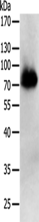 Anti-PRMT7 Rabbit Polyclonal Antibody
