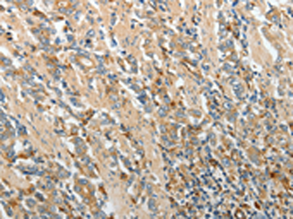 Anti-PRCP Rabbit Polyclonal Antibody