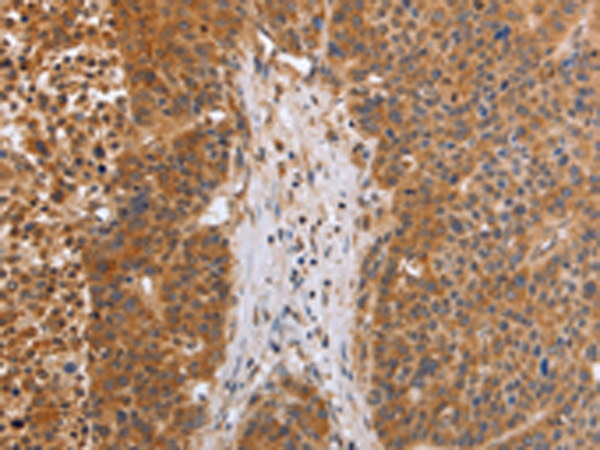 Anti-PHD3 Rabbit Polyclonal Antibody