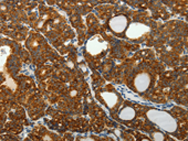 Anti-SelM Rabbit Polyclonal Antibody