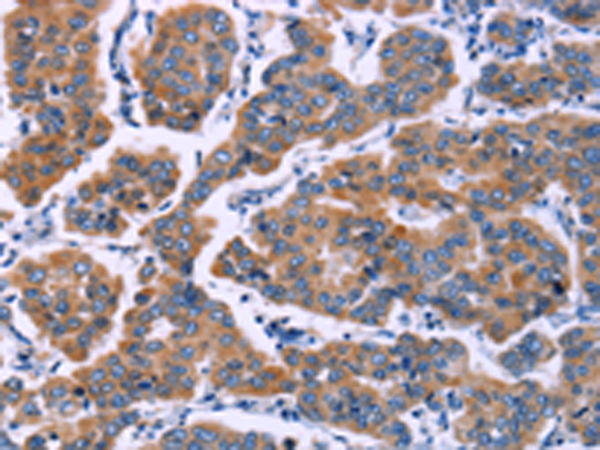 Anti-ZEB2 Rabbit Polyclonal Antibody