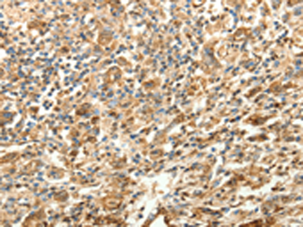 Anti-SLC25A11 Rabbit Polyclonal Antibody