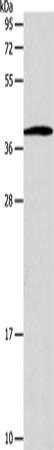 Anti-SLC25A11 Rabbit Polyclonal Antibody