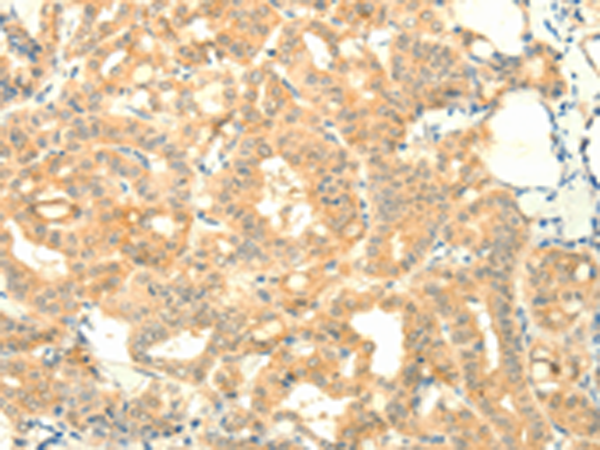Anti-SNAP25 Rabbit Polyclonal Antibody