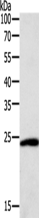 Anti-SNAP25 Rabbit Polyclonal Antibody