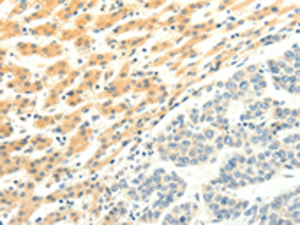 Anti-SPAG5 Rabbit Polyclonal Antibody
