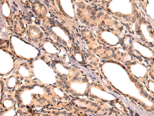 Anti-Spindlin 1 Rabbit Polyclonal Antibody