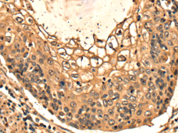 Anti-synaptotagmin 5 Rabbit Polyclonal Antibody