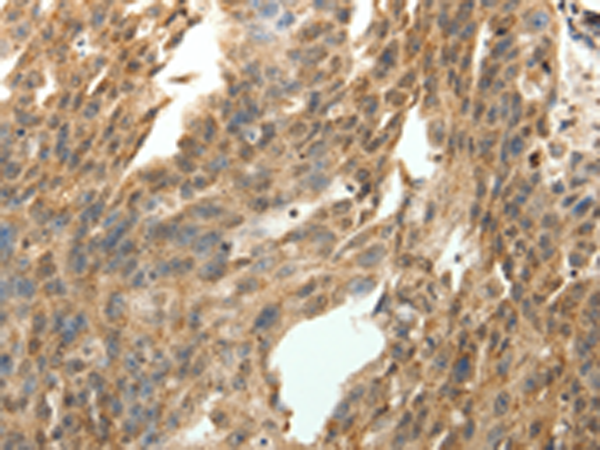 Anti-Synaptotagmin 7 Rabbit Polyclonal Antibody