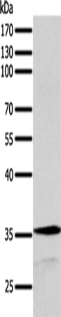 Anti-Synaptotagmin 9 Rabbit Polyclonal Antibody