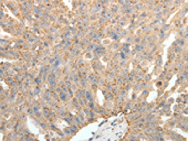 Anti-Synaptotagmin 11 Rabbit Polyclonal Antibody