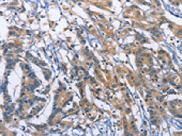 Anti-Synaptotagmin 17 Rabbit Polyclonal Antibody