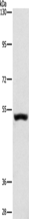 Anti-Synaptotagmin 17 Rabbit Polyclonal Antibody