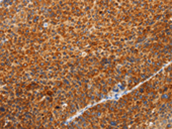 Anti-SPATA13 Rabbit Polyclonal Antibody