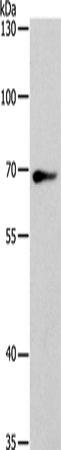Anti-SPATA13 Rabbit Polyclonal Antibody