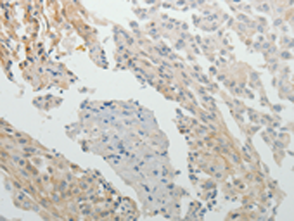 Anti-SPATA17 Rabbit Polyclonal Antibody