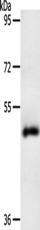 Anti-SPATA17 Rabbit Polyclonal Antibody