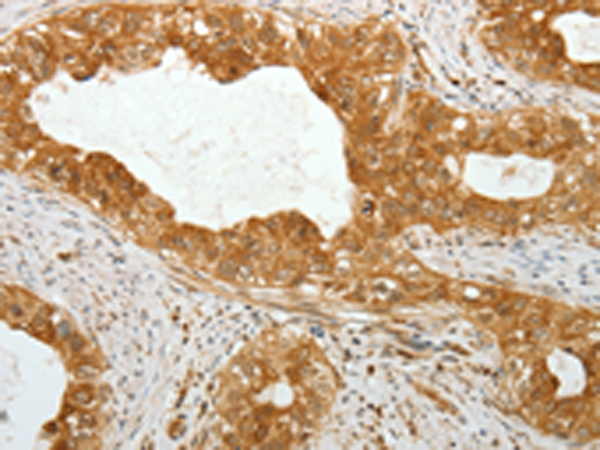 Anti-Tektin 1 Rabbit Polyclonal Antibody