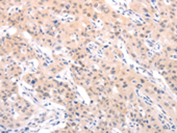 Anti-TRAF2 Rabbit Polyclonal Antibody
