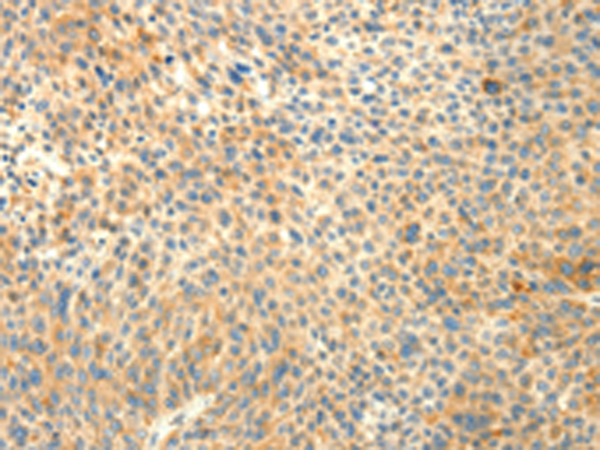 Anti-CIKS Rabbit Polyclonal Antibody