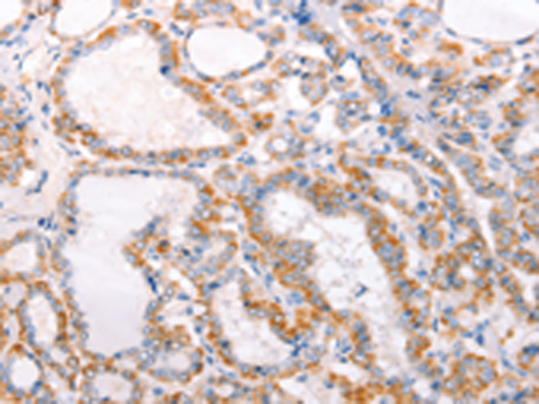 Anti-TRAF5 Rabbit Polyclonal Antibody