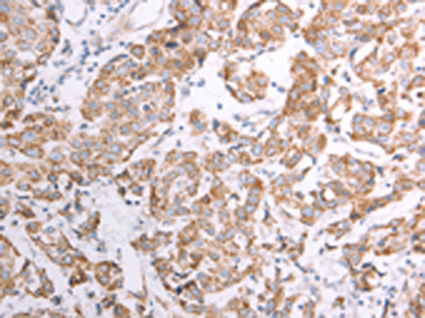 Anti-ATP5IF1 Rabbit Polyclonal Antibody