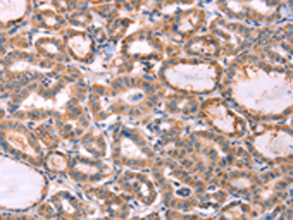Anti-PROS1 Rabbit Polyclonal Antibody