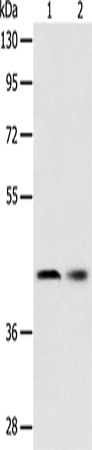 Anti-SERPINA5 Rabbit Polyclonal Antibody