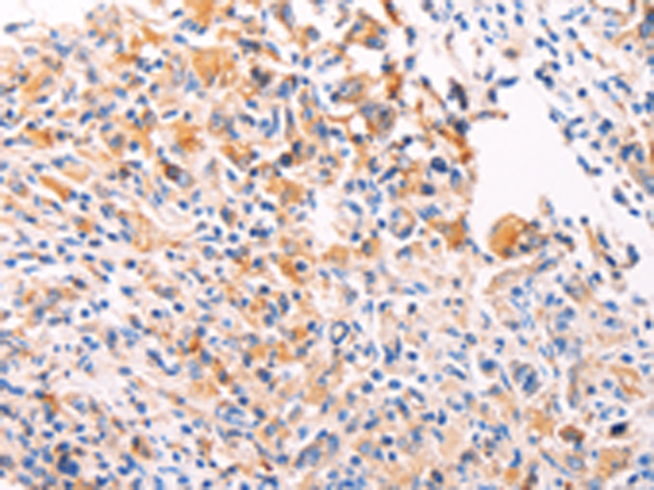 Anti-PGBD1 Rabbit Polyclonal Antibody