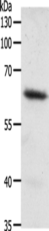 Anti-Frizzled 4 Rabbit Polyclonal Antibody
