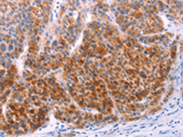 Anti-AADAC Rabbit Polyclonal Antibody