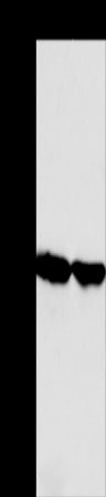 Anti-AADAC Rabbit Polyclonal Antibody