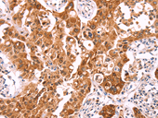 Anti-AADACL1 Rabbit Polyclonal Antibody