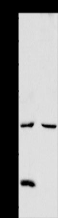 Anti-AADACL1 Rabbit Polyclonal Antibody