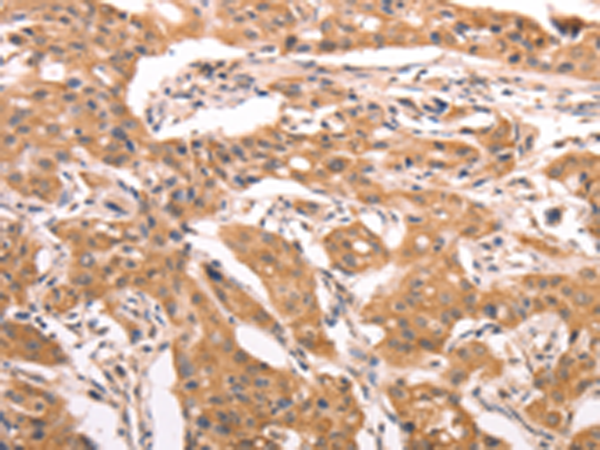 Anti-AASDHPPT Rabbit Polyclonal Antibody