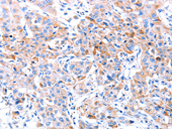 Anti-ACAA2 Rabbit Polyclonal Antibody