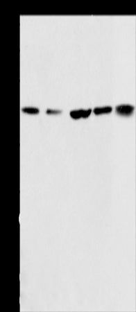 Anti-ACAA2 Rabbit Polyclonal Antibody